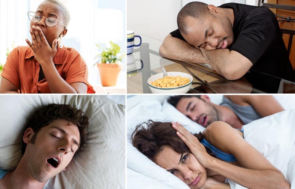 collage of 4 sleep apnea patients at different conditions
